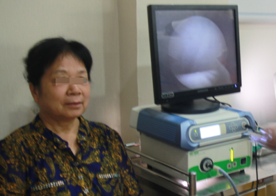 患者正在檢查腺樣體肥大