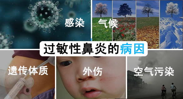 過敏性鼻炎病因